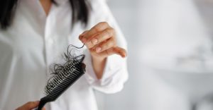 menopause hair loss treatment